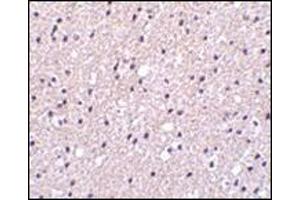 Immunohistochemistry of Presenilin1 in human brain tissue with this product at 2. (Presenilin 1 抗体  (C-Term))