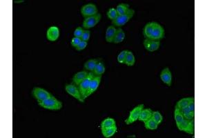Immunofluorescent analysis of HepG2 cells using ABIN7150711 at dilution of 1:100 and Alexa Fluor 488-congugated AffiniPure Goat Anti-Rabbit IgG(H+L) (MAP2K4 抗体  (AA 259-398))