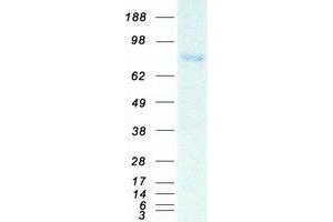Validation with Western Blot