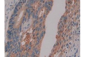 Immunohistochemistry (IHC) image for anti-Pregnancy Specific beta-1-Glycoprotein 1 (PSG1) (AA 202-401) antibody (ABIN7440083)