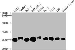 Western Blot Positive WB detected in: Hela whole cell lysate, Jurkat whole cell lysate, MCF-7 whole cell lysate, RAW264. (Recombinant TPT1 抗体)