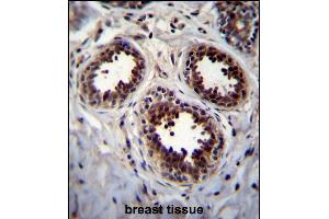Immunohistochemistry (Paraffin-embedded Sections) (IHC (p)) image for anti-Eukaryotic Translation Initiation Factor 4E Binding Protein 1 (EIF4EBP1) (AA 31-61) antibody (ABIN656558)