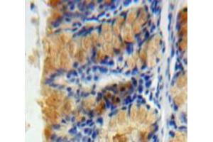 Used in DAB staining on fromalin fixed paraffin-embedded Bowels tissue (Caspase 6 抗体  (AA 194-293))