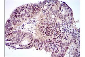 Immunohistochemistry (IHC) image for anti-CCAAT/enhancer Binding Protein (C/EBP), alpha (CEBPA) antibody (ABIN1845802)
