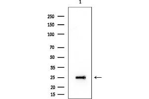 Western blot analysis of lysates from HUVEC cells, using RAN Mouse Monoclonal Antibody at 1/1000 dilution.
