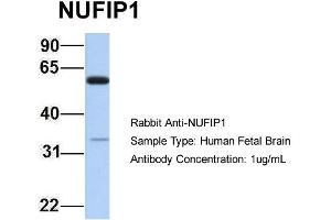 Host: Rabbit Target Name: NUFIP1 Sample Type: Human Fetal Brain Antibody Dilution: 1. (NUFIP1 抗体  (N-Term))