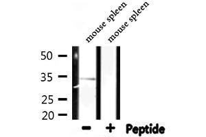 Western blot analysis of extracts from mouse spleen, using RPL5 Antibody. (RPL5 抗体  (C-Term))
