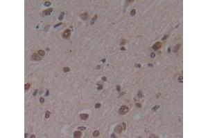 Used in DAB staining on fromalin fixed paraffin- embedded Kidney tissue (Deltex Homolog 1 抗体  (AA 290-535))