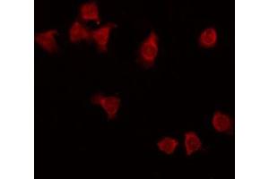 ABIN6275297 staining HT29 by IF/ICC. (NXPH3 抗体  (Internal Region))