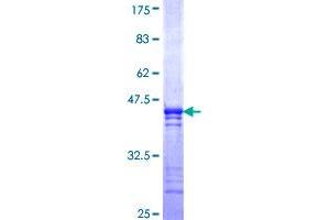 COLQ Protein (AA 356-455) (GST tag)