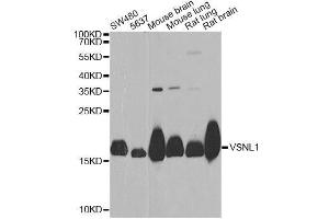 Western blot analysis of extracts of various cell lines, using VSNL1 Antibody. (VSNL1 抗体  (AA 1-191))