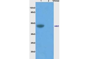 Lane 1: mouse brain lysates Lane 2: human colon carcinoma lysates probed with Anti SynCAM/TSLC1 Polyclonal Antibody, Unconjugated (ABIN761351) at 1:200 in 4 °C. (CADM1 抗体  (AA 65-160))