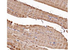 IHC analysis of CACNA1S using anti-CACNA1S antibody (ABIN7600160).