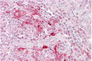Immunohistochemistry with Spleen tissue at an antibody concentration of 5µg/ml using anti-ETV5 antibody (ARP32264_P050) (ETV5 抗体  (N-Term))