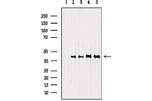 Western blot analysis of extracts from various samples, using NSDHL Antibody. (NSDHL 抗体  (Internal Region))