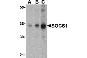 Western Blotting (WB) image for anti-Suppressor of Cytokine Signaling 1 (SOCS1) (N-Term) antibody (ABIN1031580) (SOCS1 抗体  (N-Term))