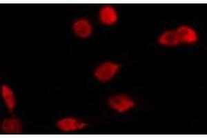 ABIN6274113 staining Hela cells by IF/ICC. (LMX1B 抗体  (Internal Region))