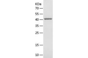 Western Blotting (WB) image for V-Akt Murine Thymoma Viral Oncogene Homolog 1 (AKT1) (AA 1-149) protein (GST tag) (ABIN7281757) (AKT1 Protein (AA 1-149) (GST tag))