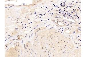 Detection of AR in Human Prostate Tissue using Polyclonal Antibody to Androgen Receptor (AR) (Androgen Receptor 抗体  (AA 15-246))