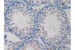 IHC-P analysis of Mouse Testis Tissue, with DAB staining. (OLR1 抗体  (AA 60-312))