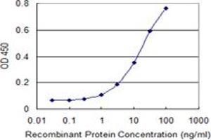 Detection limit for recombinant GST tagged ALDH18A1 is 0. (P5CS 抗体  (AA 696-795))