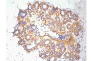 Immunohistochemistry (IHC) staining of Human Ovary tissue, diluted at 1:200. (beta Actin 抗体)