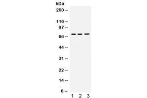 Western blot testing of human 1) 22RV1, 2) SW579 and 3) A549 cell lysate with Myelin-associated glycoprotein antibody. (MAG 抗体)