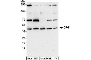 Western Blotting (WB) image for anti-Developmentally Regulated GTP Binding Protein 1 (DRG1) (AA 200-250) antibody (ABIN7450185)