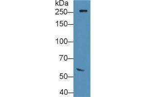 Detection of FN in Rat Serum using Polyclonal Antibody to Fibronectin (FN) (Fibronectin 抗体  (AA 355-558))