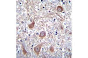 Formalin fixed and paraffin embedded human brain tissue reacted with PTCHD1 Antibody (Center) followed by peroxidase conjugation of the secondary antibody and DAB staining. (PTCHD1 抗体  (Middle Region))