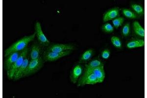 Immunofluorescent analysis of HepG2 cells using ABIN7157603 at dilution of 1:100 and Alexa Fluor 488-congugated AffiniPure Goat Anti-Rabbit IgG(H+L) (KIF17 抗体  (AA 500-777))
