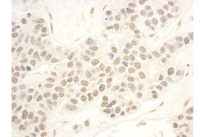 anti-NOP56 Ribonucleoprotein Homolog (NOP56) (AA 494-544) antibody