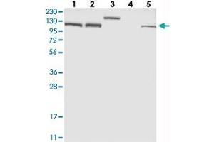 Western blot analysis of Lane 1: RT-4, Lane 2: U-251 MG, Lane 3: Human Plasma, Lane 4: Liver, Lane 5: Tonsil with EFTUD2 polyclonal antibody  at 1:250-1:500 dilution. (EFTUD2 抗体)