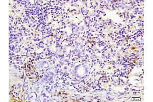 Formalin-fixed and paraffin embedded rabbit pancreas labeled with Rabbit Anti pro-caspase-3 Polyclonal Antibody, Unconjugated (ABIN747728) at 1:200 followed by conjugation to the secondary antibody and DAB staining (Caspase 3 抗体  (AA 11-120))