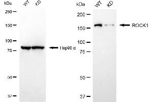 Western blotting analysis using ROCK1 antibody (ABIN7800203).
