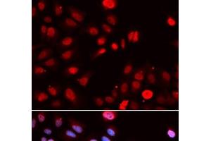 Immunofluorescence analysis of U2OS cells using MPG Polyclonal Antibody (MPG 抗体)