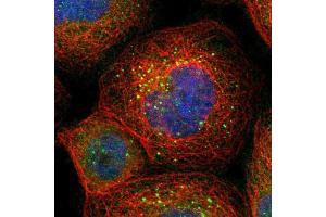Immunofluorescent staining of human cell line A-431 shows localization to vesicles. (BAG5 抗体  (AA 249-399))