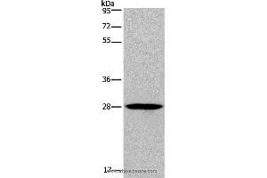 Western blot analysis of Human bladder carcinoma tissue, using KLRF1 Polyclonal Antibody at dilution of 1:300 (KLRF1 抗体)
