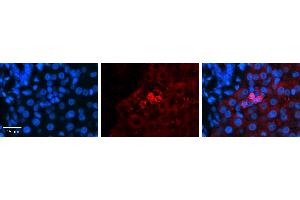 SHMT2 antibody - C-terminal region          Formalin Fixed Paraffin Embedded Tissue:  Human Liver Tissue    Observed Staining:  Cytoplasm in Kupffer cells   Primary Antibody Concentration:  1:600    Secondary Antibody:  Donkey anti-Rabbit-Cy3    Secondary Antibody Concentration:  1:200    Magnification:  20X    Exposure Time:  0. (SHMT2 抗体  (C-Term))