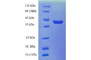SDS-PAGE (SDS) image for Cellular Retinoic Acid Binding Protein 1 (CRABP1) (AA 2-137) protein (GST tag) (ABIN5709319) (CRABP1 Protein (AA 2-137) (GST tag))