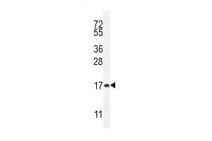 SCA5 Antibody (Center) (ABIN655746 and ABIN2845192) western blot analysis in mouse heart tissue lysates (35 μg/lane). (SPACA5 抗体  (AA 40-69))