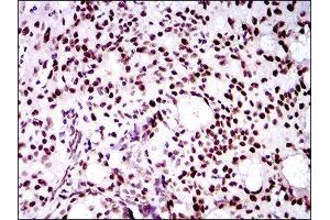 Immunohistochemistry (IHC) image for anti-Twist Homolog 1 (Drosophila) (TWIST1) (AA 9-74) antibody (ABIN1842915) (TWIST1 抗体  (AA 9-74))