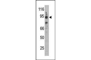 The anti-Synphilin-1 C-term Pab is used in Western blot to detect Synphilin-1 in mouse brain lysate.