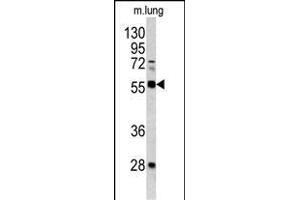Western blot analysis of FLI1 antibody (Center) (ABIN390409 and ABIN2840798) in mouse lung tissue lysates(35 μg/lane). (FLI1 抗体  (AA 299-328))