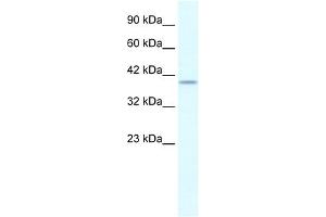 PHKG2 antibody used at 0. (PHKG2 抗体)