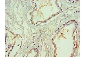 Immunohistochemistry of paraffin-embedded human prostate tissue using ABIN7170623 at dilution of 1:100 (SF3B3 抗体  (AA 948-1217))