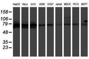 Image no. 3 for anti-Protein Phosphatase 1, Regulatory (Inhibitor) Subunit 15A (PPP1R15A) antibody (ABIN1498364) (GADD34 抗体)