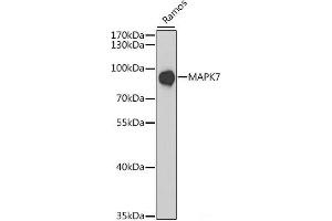 Western blot analysis of extracts of Ramos cells using MAPK7 Polyclonal Antibody at dilution of 1:1000. (MAPK7 抗体)