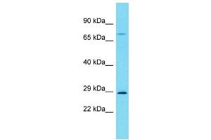 Host:  Rabbit  Target Name:  Rrp7a  Sample Type:  Rat Spleen lysates  Antibody Dilution:  1. (RRP7A 抗体  (C-Term))