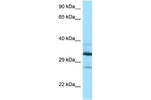 WB Suggested Anti-DOHH Antibody Titration: 1. (DOHH 抗体  (N-Term))